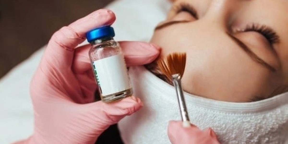 Best Age to Start Chemical Peel Treatments