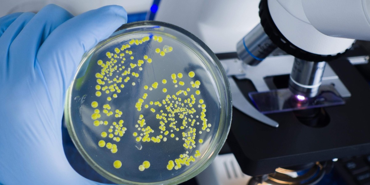 Global E. coli Testing Market: Innovations in Vessel Tracking and Fleet Management
