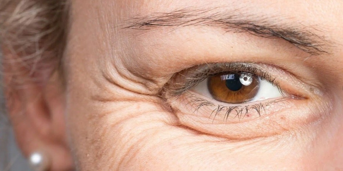 Real Results: Before & After Wrinkle Treatments in Riyadh