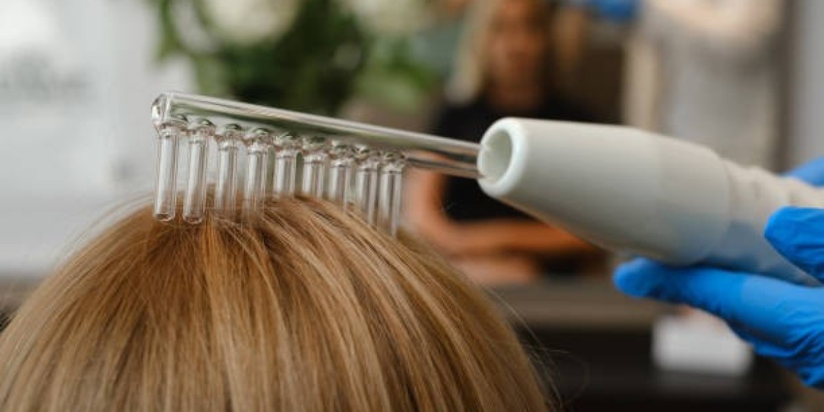 The Non-Surgical Solution for Hair Loss: Exosomes Therapy in Riyadh