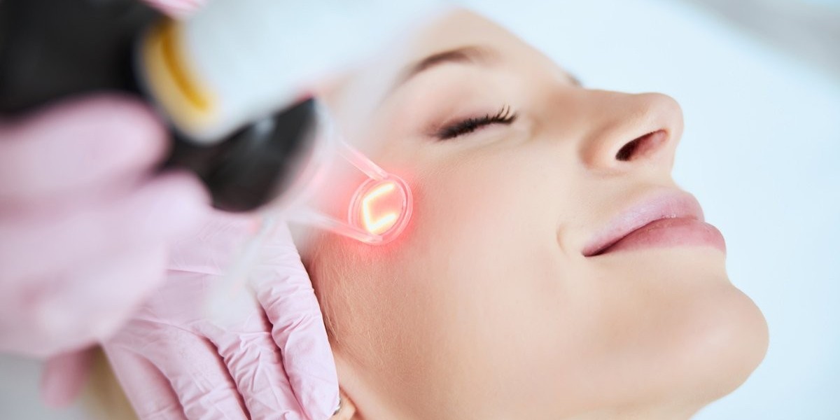 Get Rid of Stretch Marks with CO2 Laser Therapy: A Complete Guide