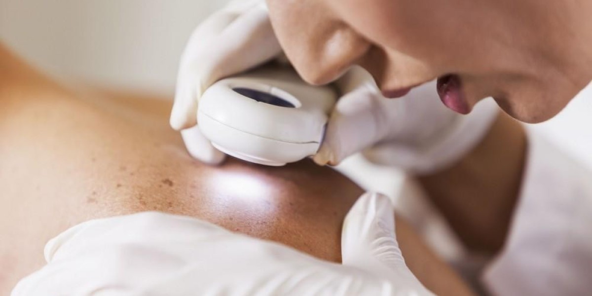 Best Dermatologist Tips to Prevent and Treat Eczema Flare-Ups