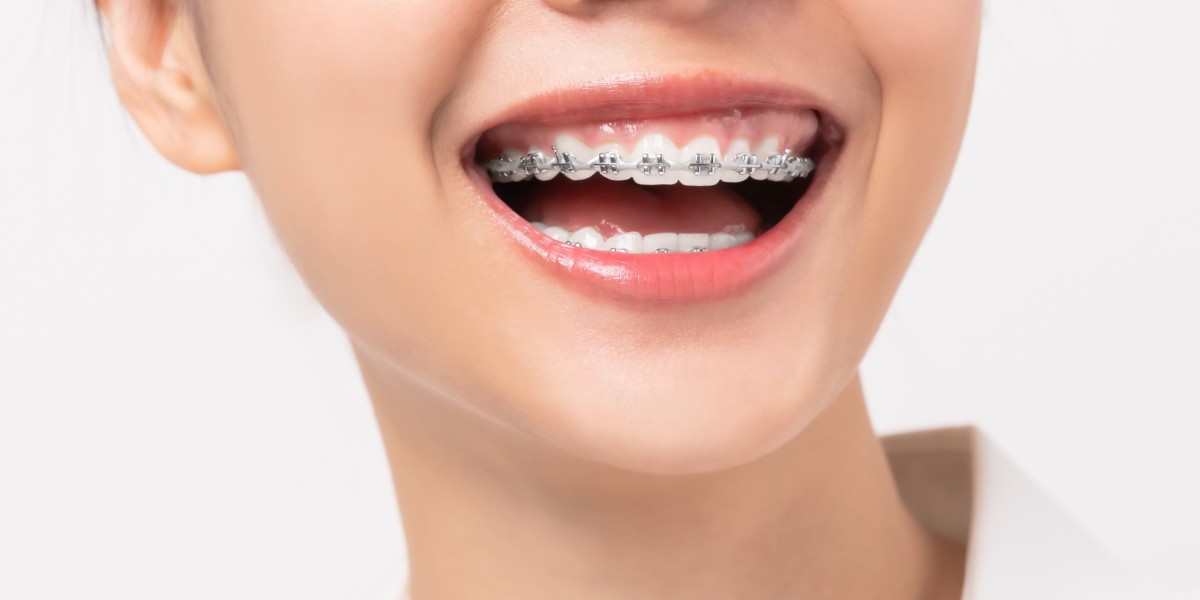 The Rise of Virtual Orthodontics: Are the Best Orthodontists On Board?