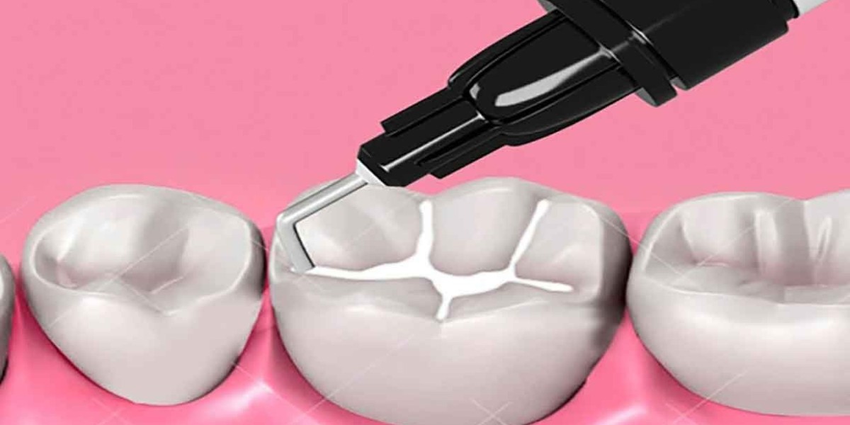 Dental Sealants Market Growth Driven by Preventive Dental Care and Increasing Global Oral Health Awareness