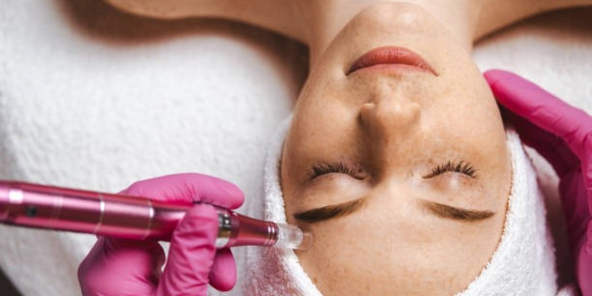 Erase Time with a Simple Derma Pen Session