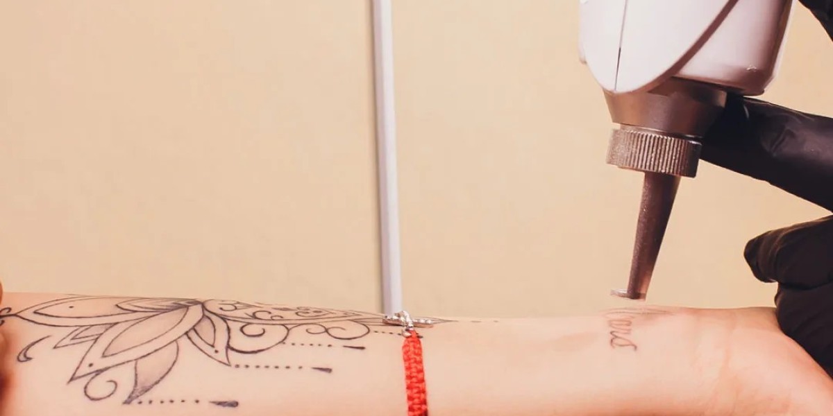 How Laser Tattoo Removal Promotes Skin Healing and Renewal