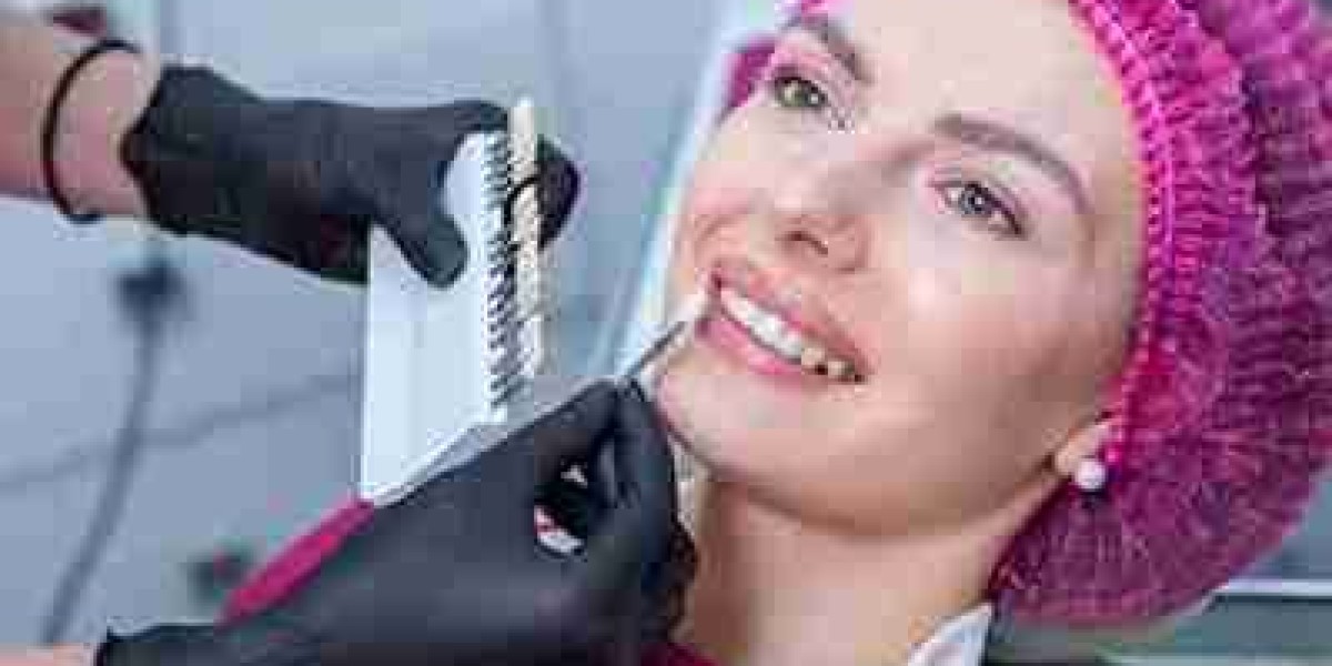 Whiter Teeth with Smart Eating: How Diet Impacts Your Smile