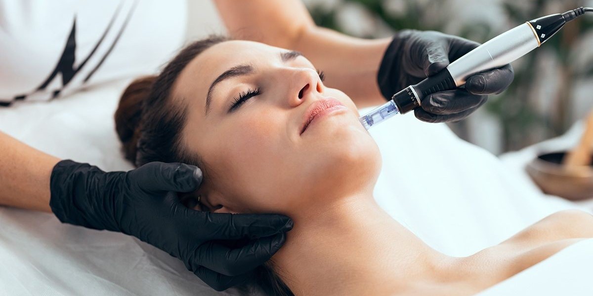 Why Islamabad Brides Choose Microneedling for Pre-Wedding Glow
