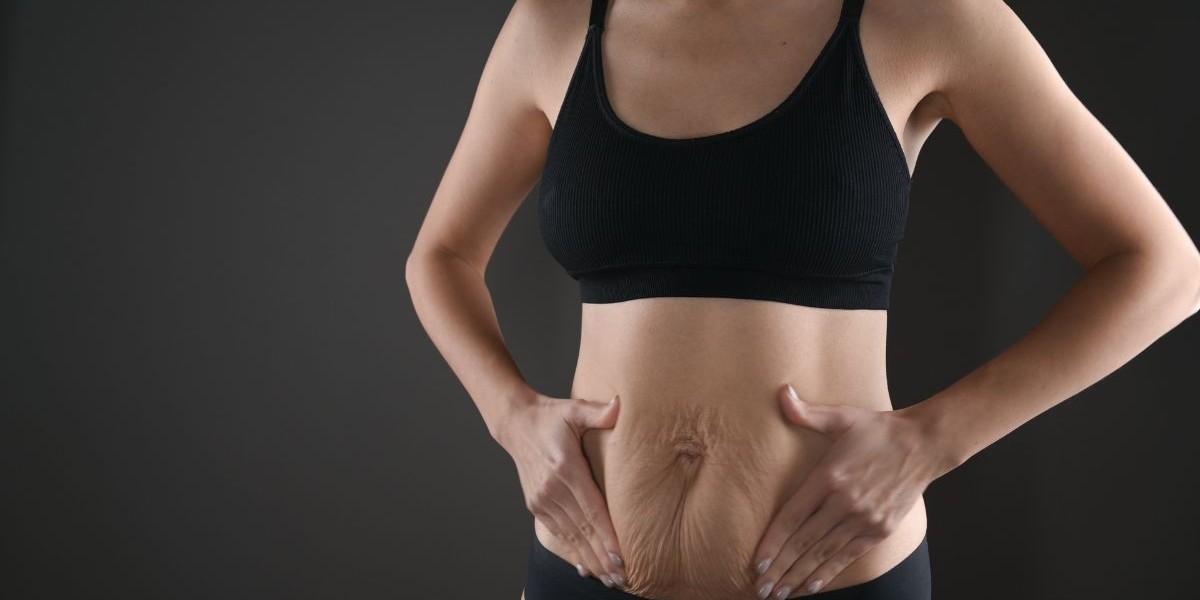 Who Is a Good Candidate for Bariatric Surgery in Islamabad?