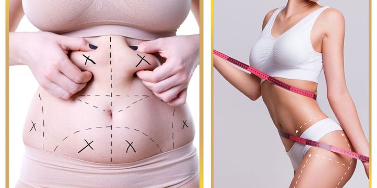 How Safe Is Liposuction in Islamabad? A Guide to Clinics and Surgeons