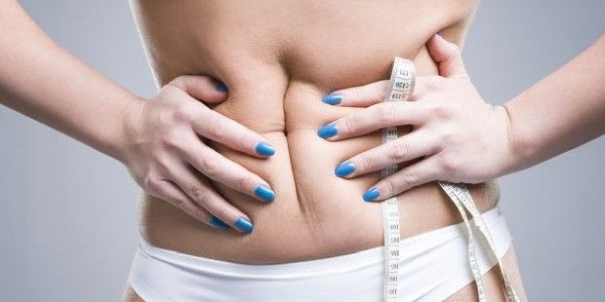 Preparing for a Tummy Tuck in Riyadh: Your Comprehensive Guide