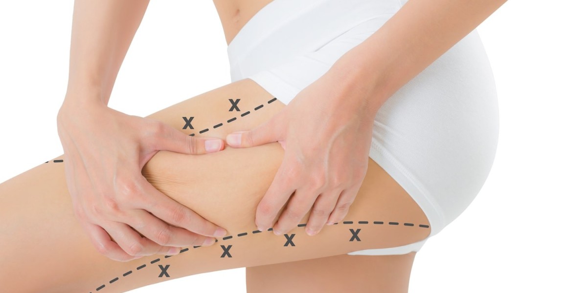 Riyadh Thigh Lift Before & After