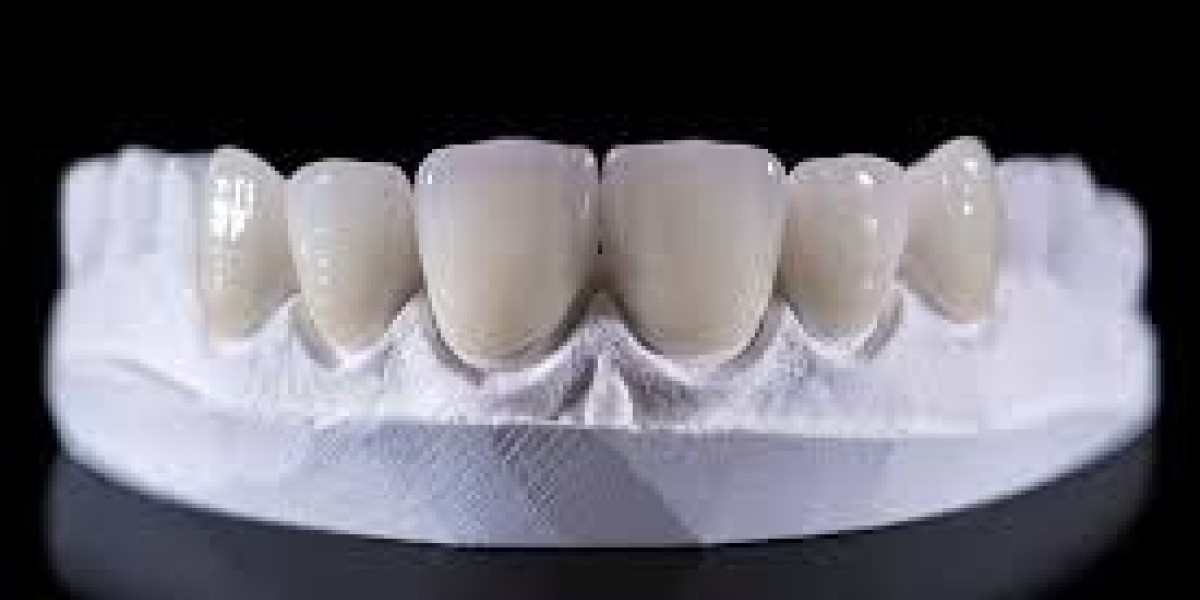 Dental Ceramic Market overview focusing on regional market size and trends
