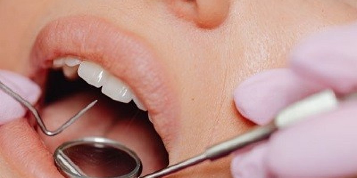 Top 10 Benefits of Dental Implants
