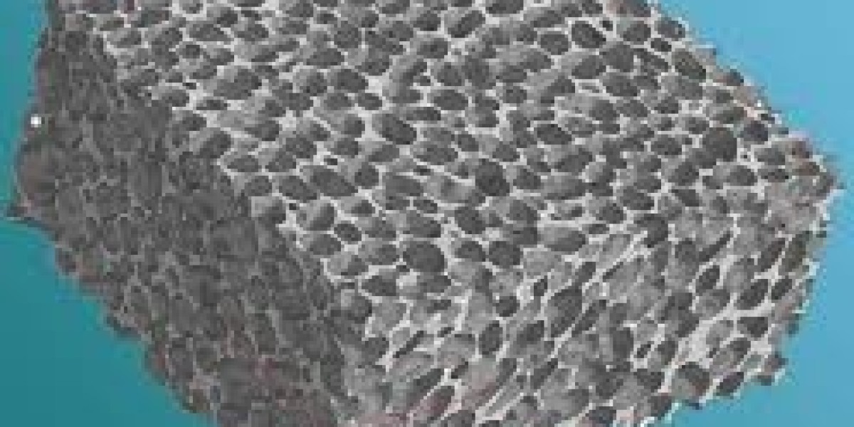 Future Outlook and Market Insights for Metal Foam Industry Growth and Forecast by 2030