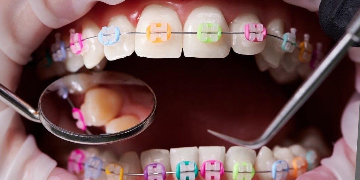Why More Adults Are Visiting Orthodontists Than Ever Before