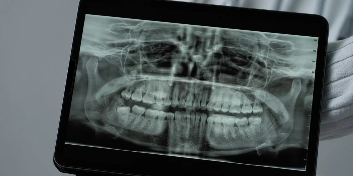 The Importance of Wisdom Tooth Removal and Where to Get It Done in Malaysia