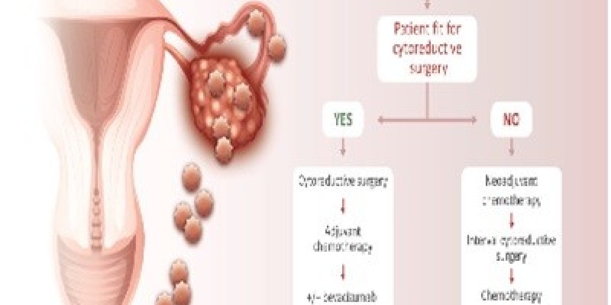 Ovarian Cancer Treatment Market Research Covering Growth Analysis And Industry Trends with Forecast 2031