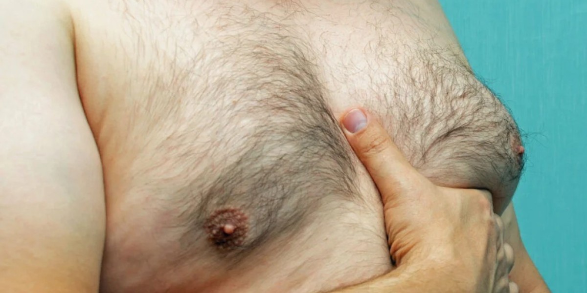 Gynecomastia Empowerment Starts with the Right Solution