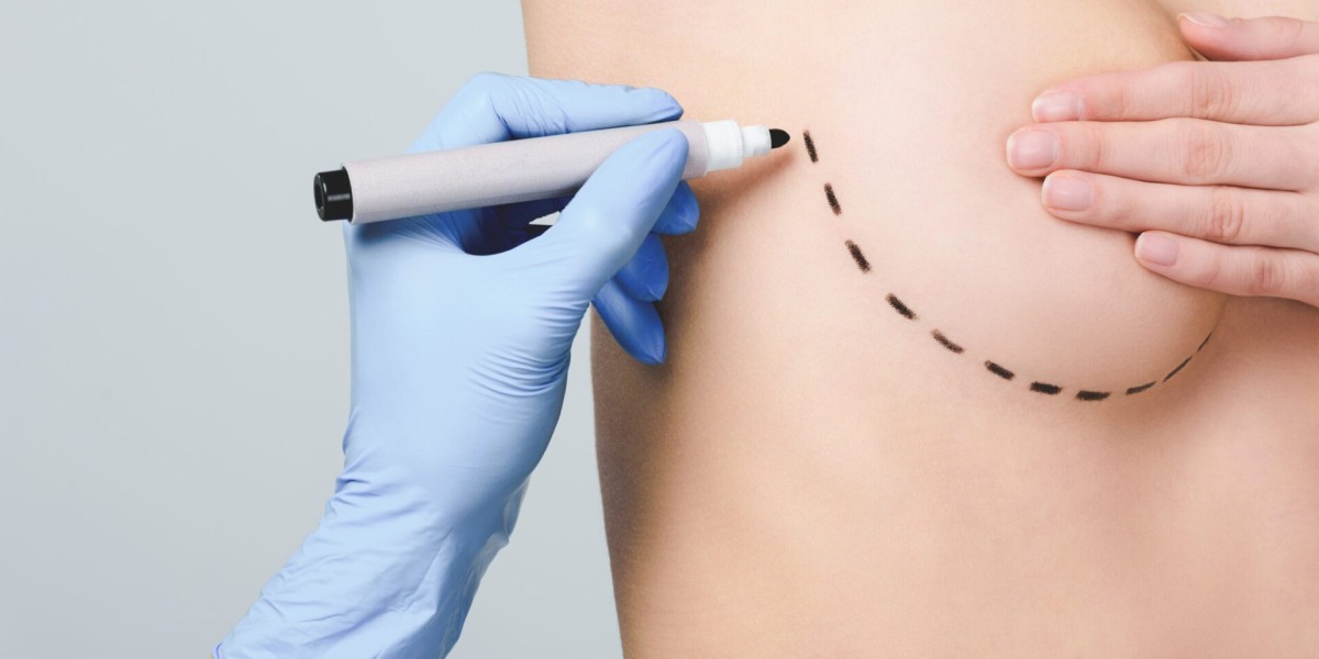 Best Time of Year to Get Breast Implants in Islamabad