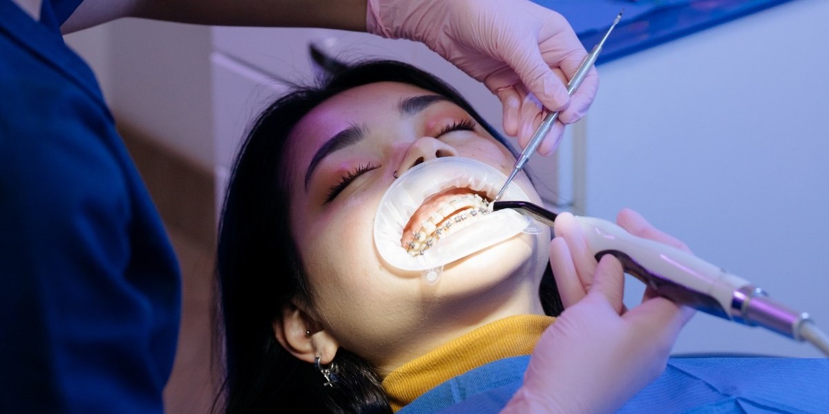 Top Advantages of CAD-CAM Dental Services for Restorative Treatments