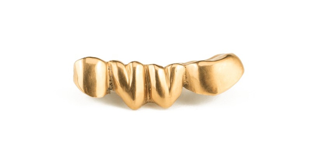 Goldhändler in Berlin – So finden Sie den besten Partner für Ihren Goldverkauf