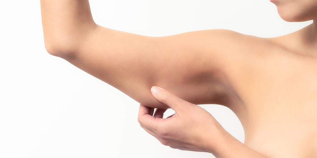 Brachioplasty for Aging Arms: Does It Work