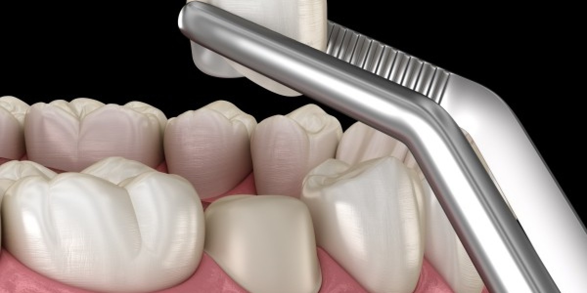 Bạn có bao giờ tự hỏi: những chiếc kẹp nhỏ, dụng cụ móc hay đầu khoan mà bác sĩ sử dụng khi khám răng là gì và có tác dụ