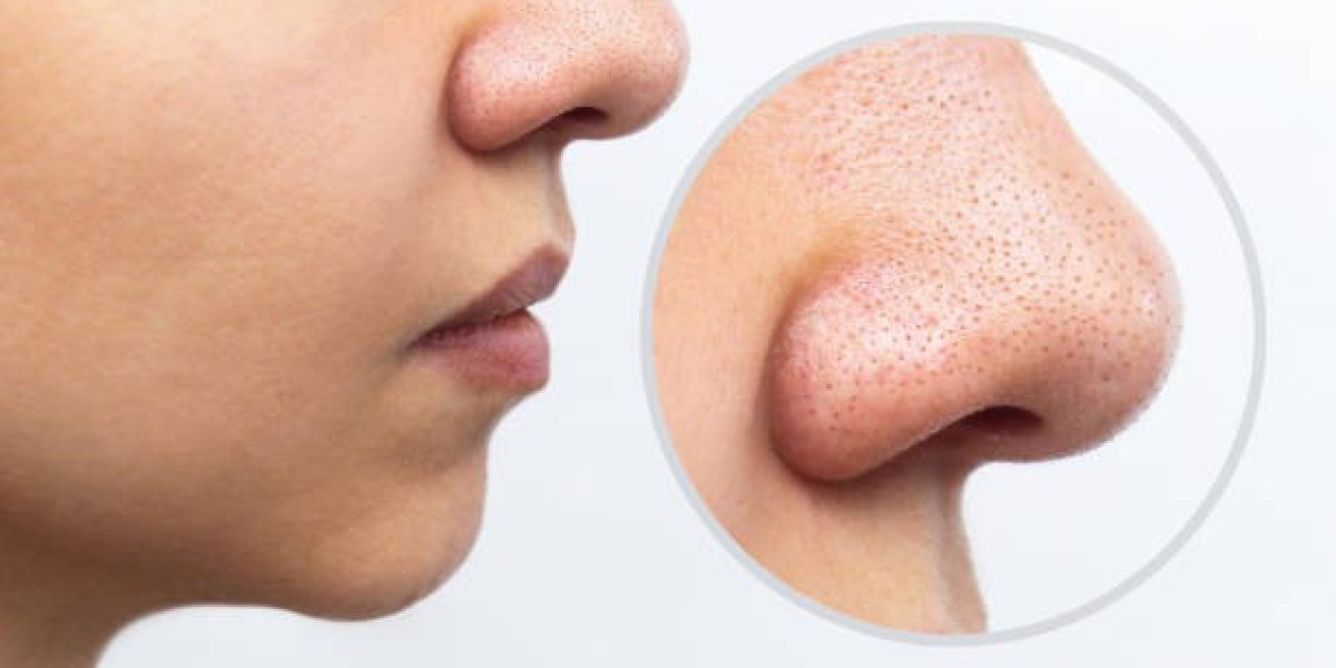 Large Pores Treatment: Natural Glow