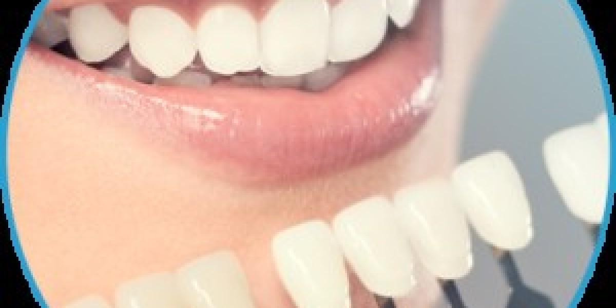 Discover Expert Dental Care with a Trusted Dentist on New Bern Ave