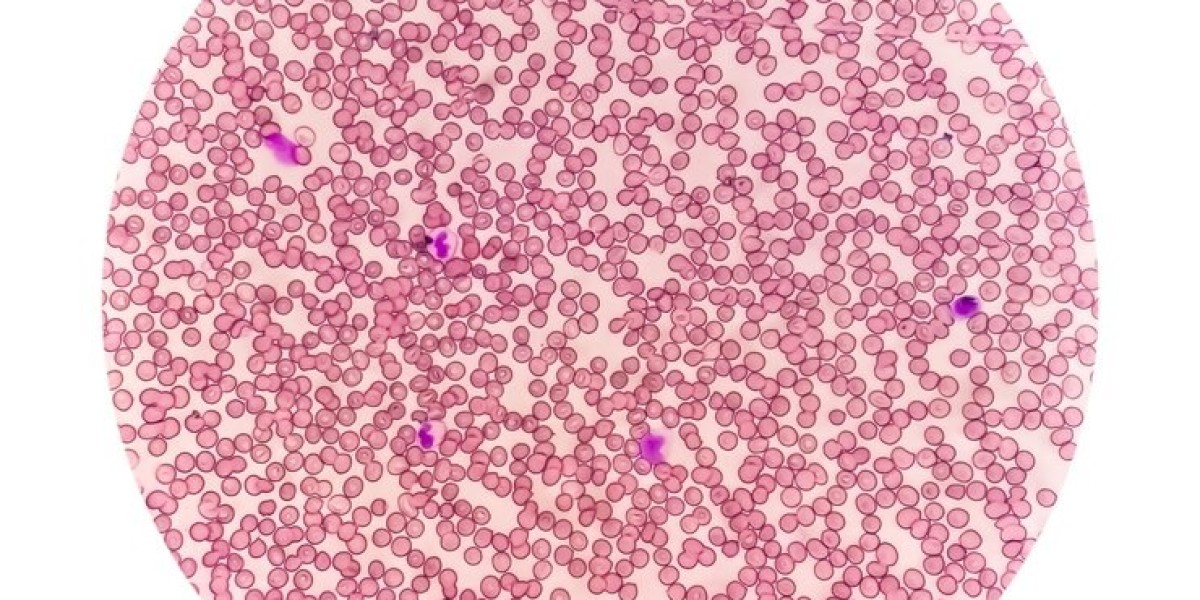 Autologous Cell Therapy Market Showcasing Dynamic Shifts in Personalized Regenerative Medicine Landscape
