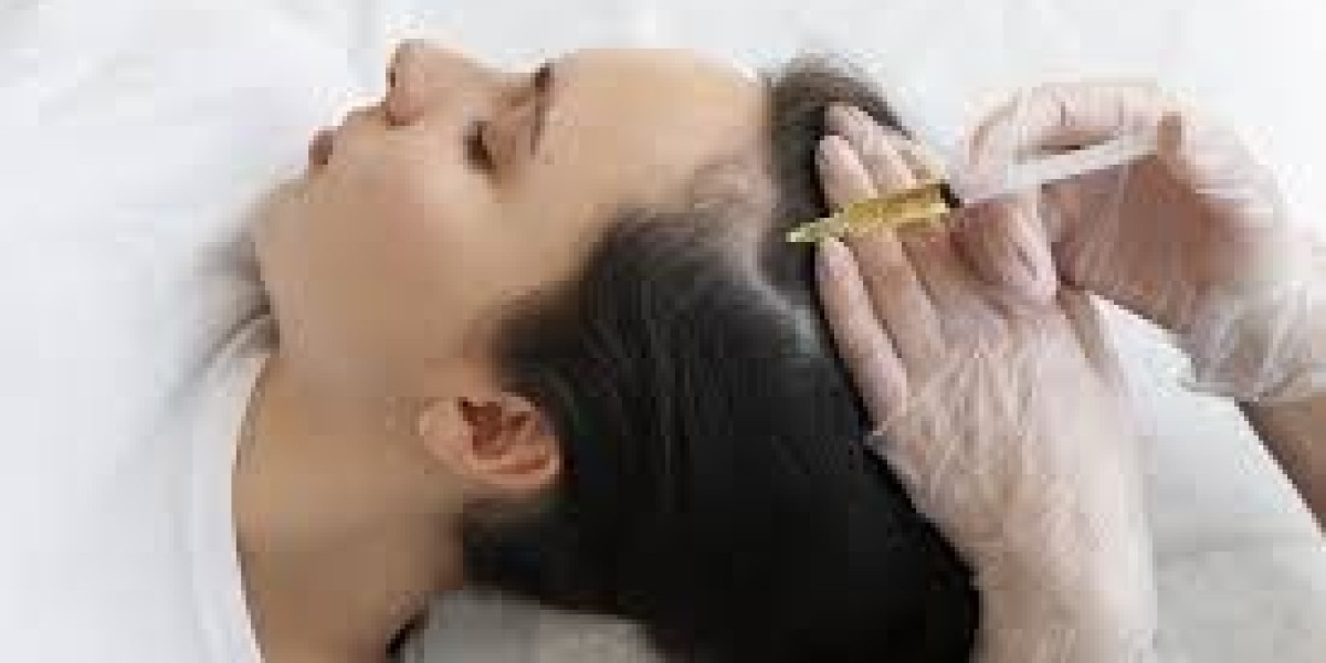 Hair Transplant in Dubai: How to Prepare Mentally and Physically for the Procedure