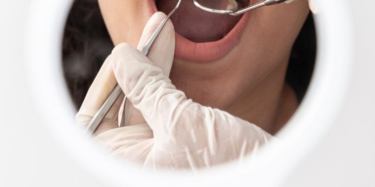Cosmetic Dentist Riyadh: Crafting Your Perfect Smile