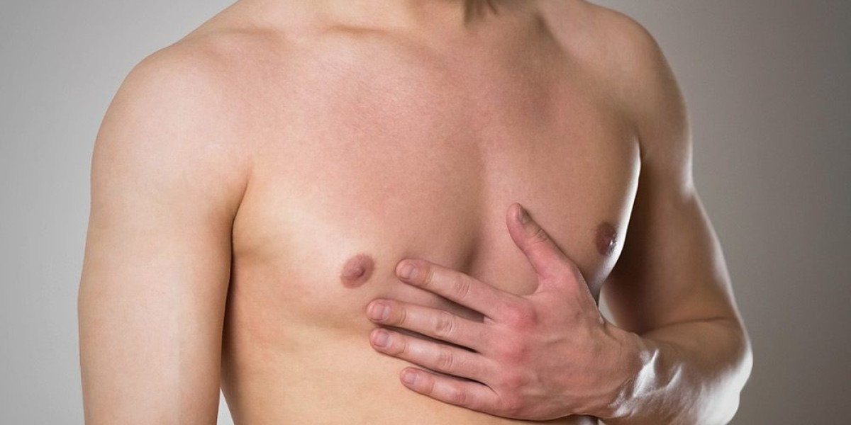 Confidence Tips for Men Who Struggle With Gynecomastia