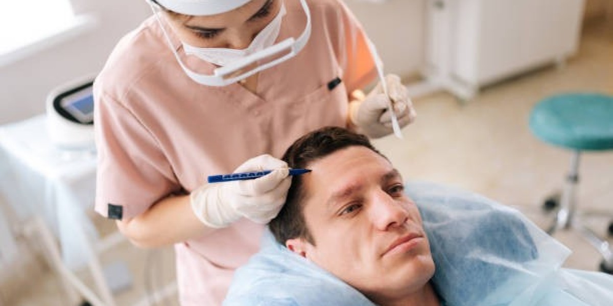 Best Time for FUE Hair Transplant in Riyadh