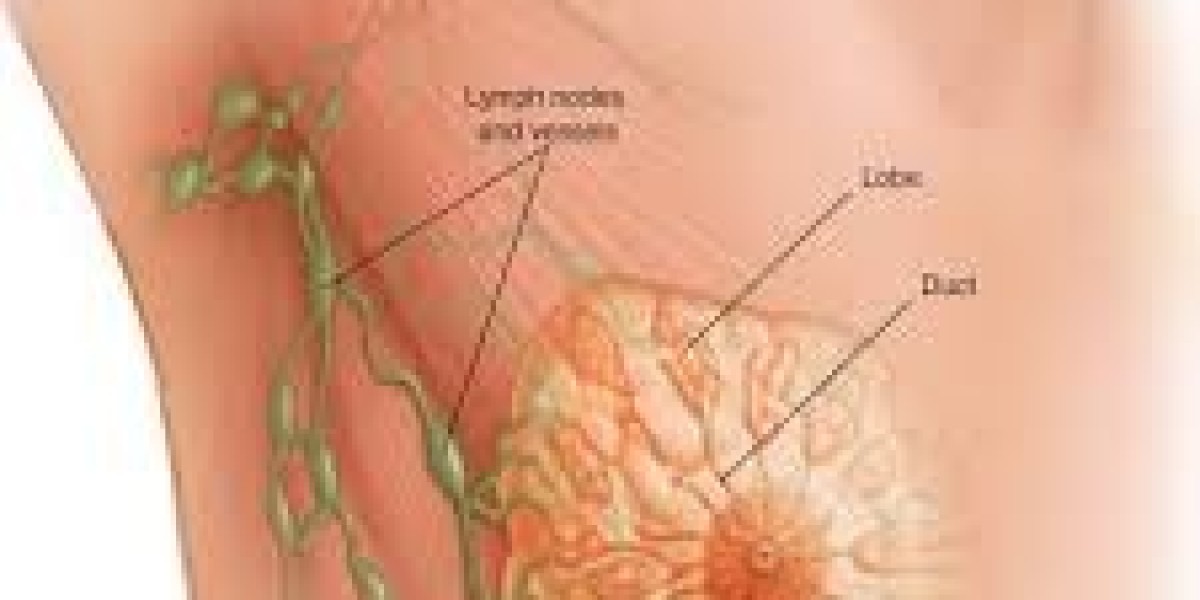 Key Drivers and Challenges in the Global Breast Cancer Market Outlook 2022–2032