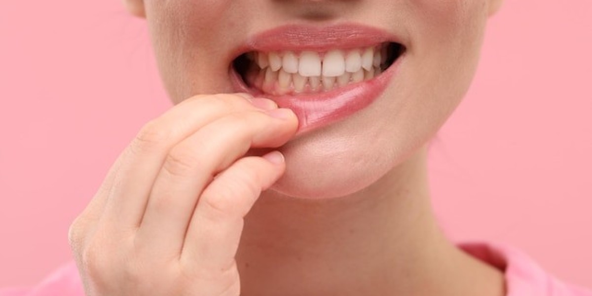 Comparing Gum Depigmentation to Teeth Whitening: Which Has Bigger Impact?