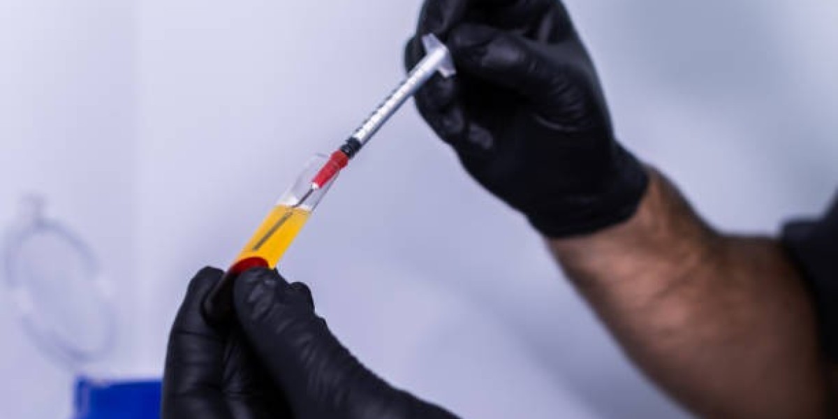 PRP Hair Treatment in Riyadh – Science Meets Beauty