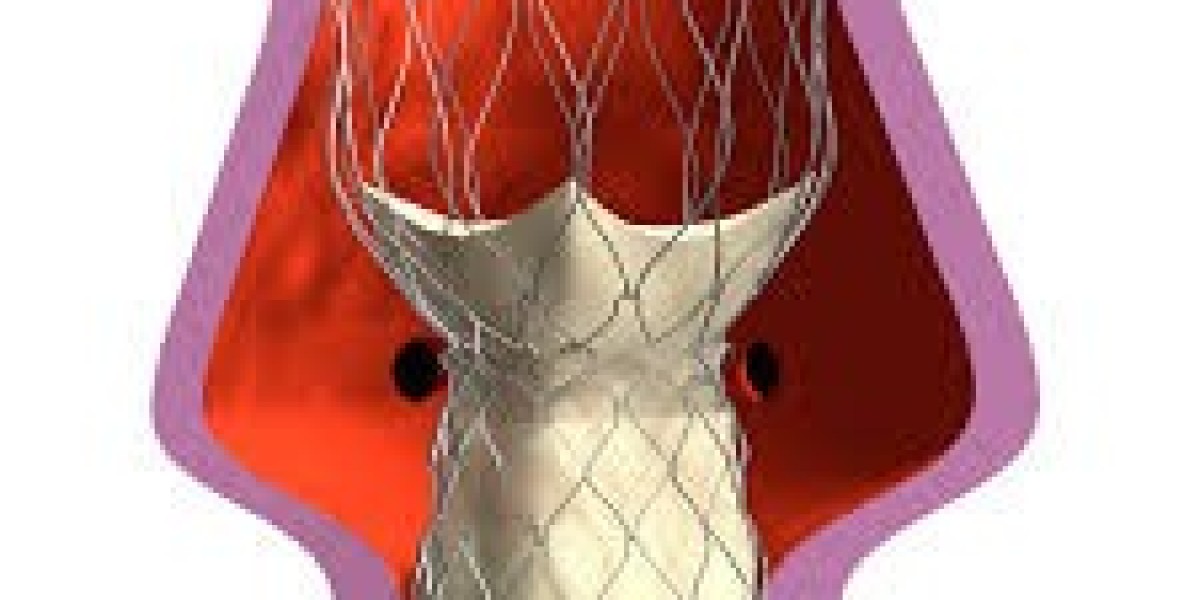 Heart Valve Devices Market Forecast Predicts Robust Growth and Technological Advancements