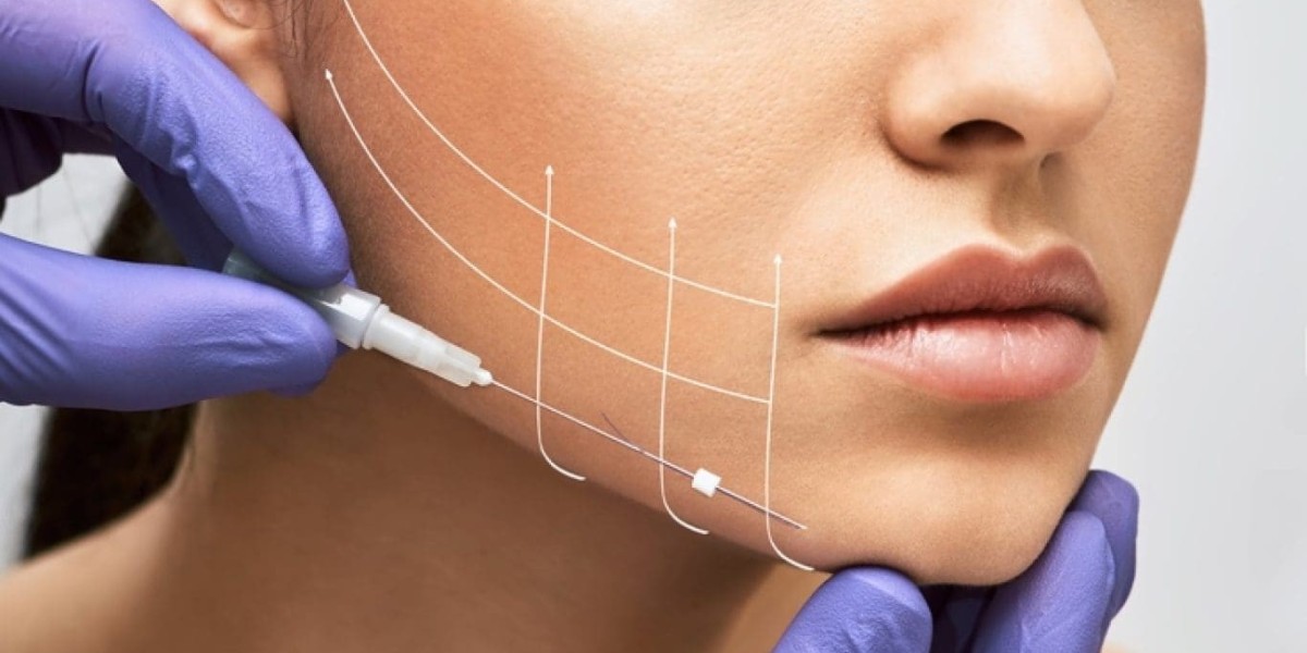 Can Thread Lift Replace Fillers in Islamabad? A Modern Aesthetic Perspective