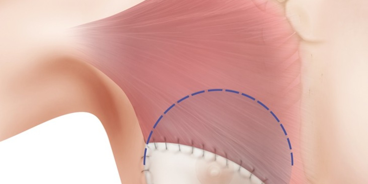Hospitals Lead Breast Reconstruction Market with 42.6% Share in 2025