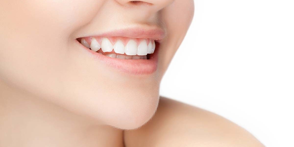 Tips for Finding Affordable Gum Contouring Options Near You