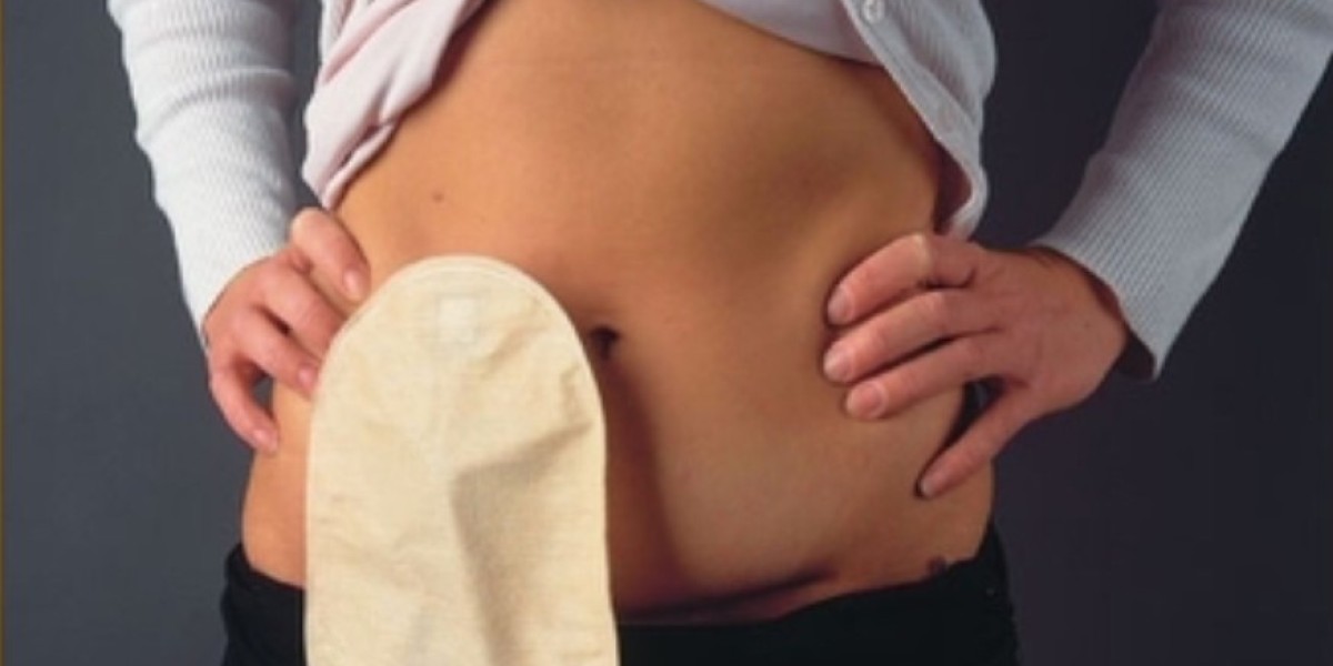 Ostomy Devices Market Set for Expansion with Rising Incidence of Inflammatory Bowel Diseases