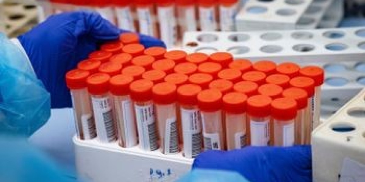Global COVID-19 Sample Collection Kits Market Dynamics and Future Outlook to 2030