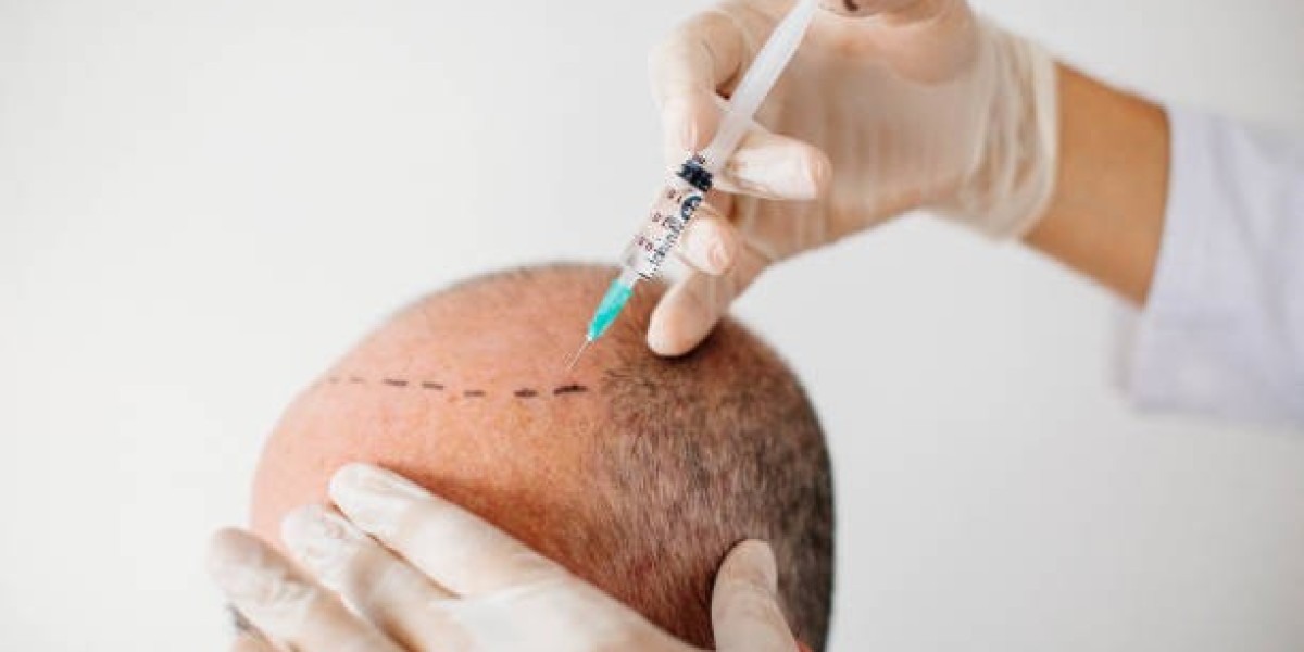 Hair Transplant Cost in Dubai for Men and Women: What's the Difference?