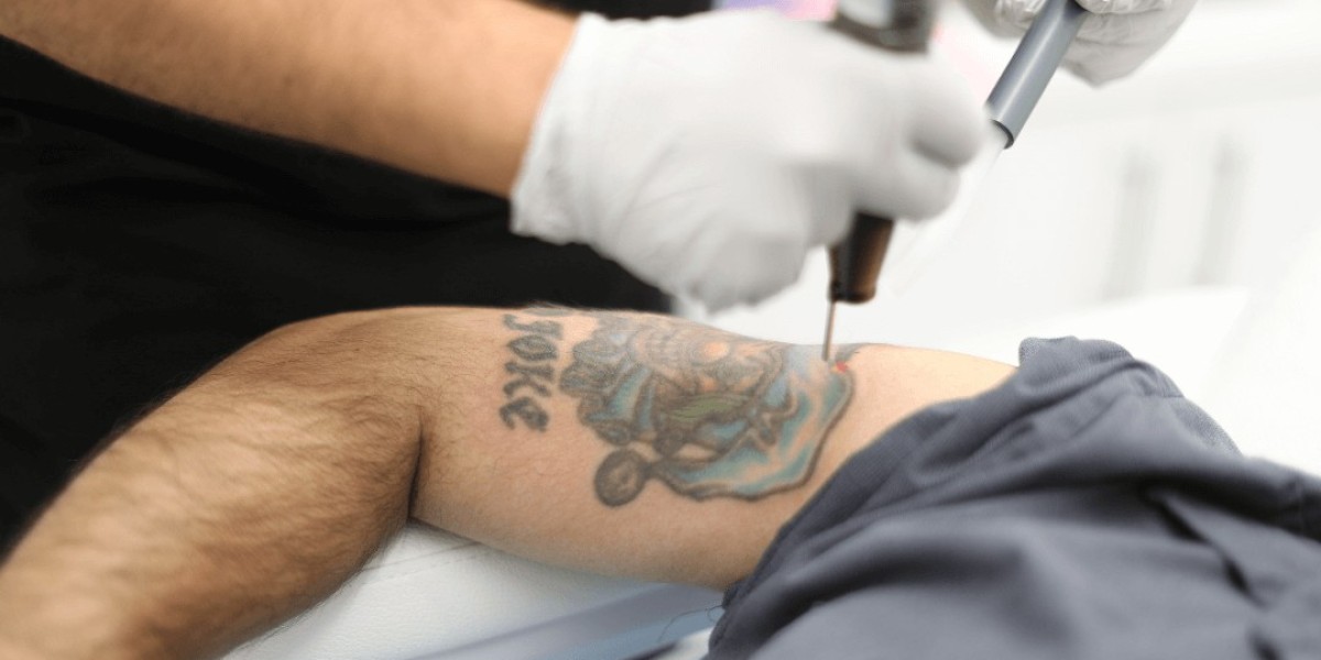 Fading Old Ink with Picosure Tattoo Removal: A Revolutionary Approach