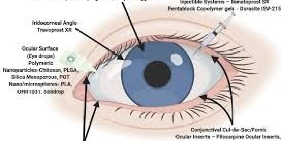 Ocular Drug Delivery System Market Global Forecast Report with Key Insights Till 2030