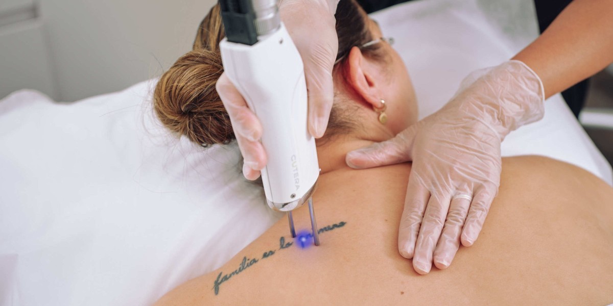 How Laser Tattoo Removal Provides Safe and Controlled Tattoo Removal