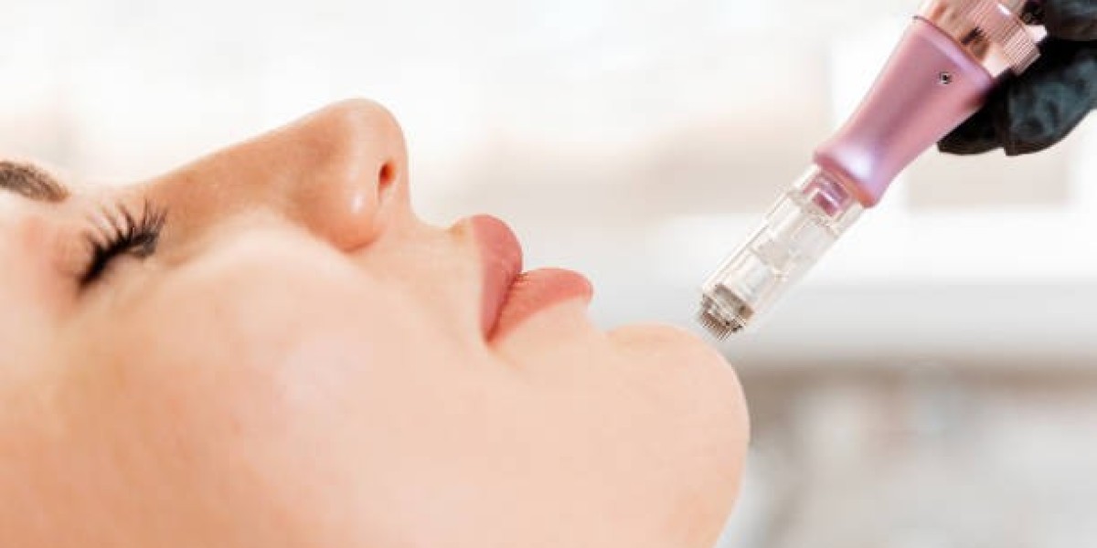 Preparing Your Skin for Derma Pen Treatment