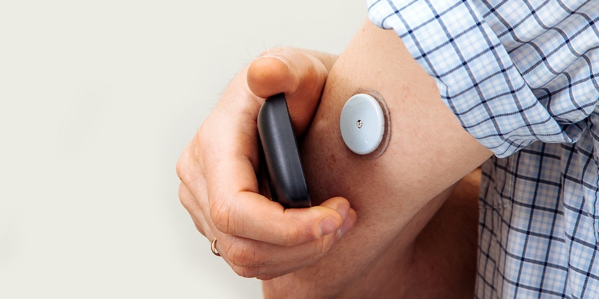 Glucose Sensors Market: Insights into Competitive Landscape and Top Manufacturers